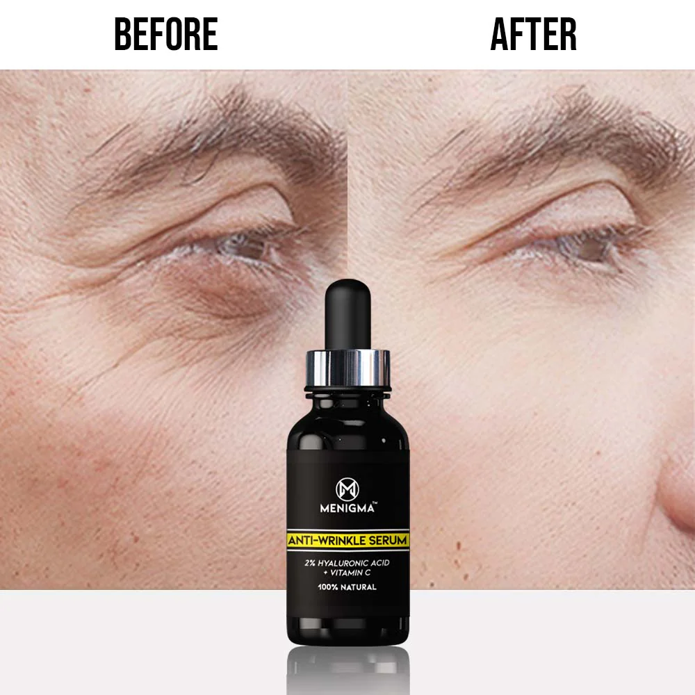 Anti-Wrinkle Serum - 3